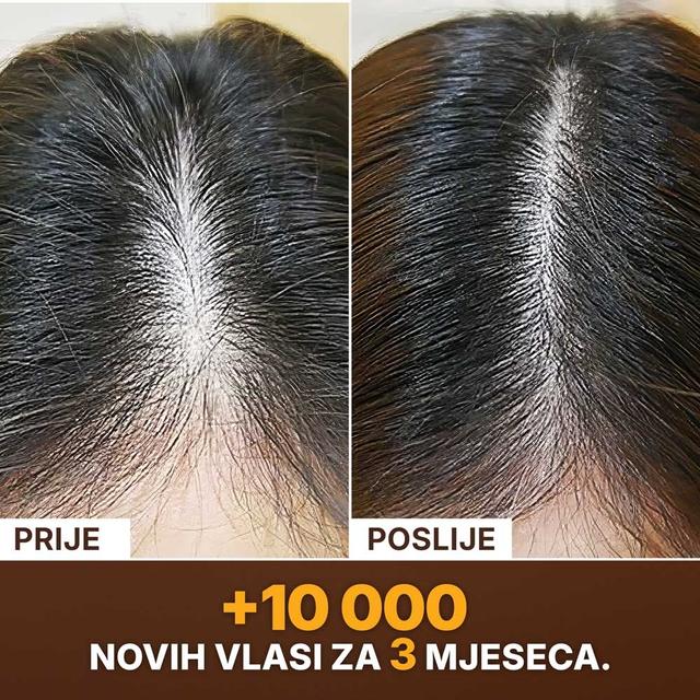 SLAJD-PRIJE-POSLIJE
