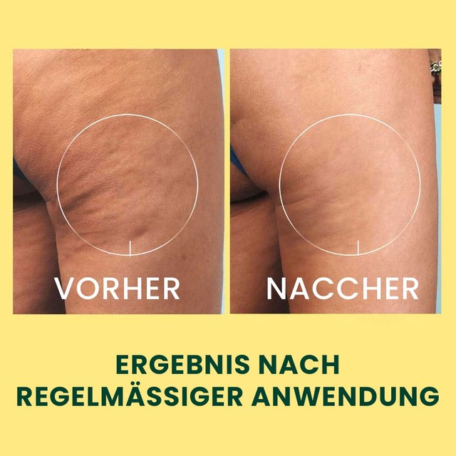 DREN-STICK---slajd-3-de