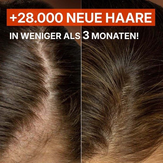 SLAJD-7----PRIJE-POSLIJE