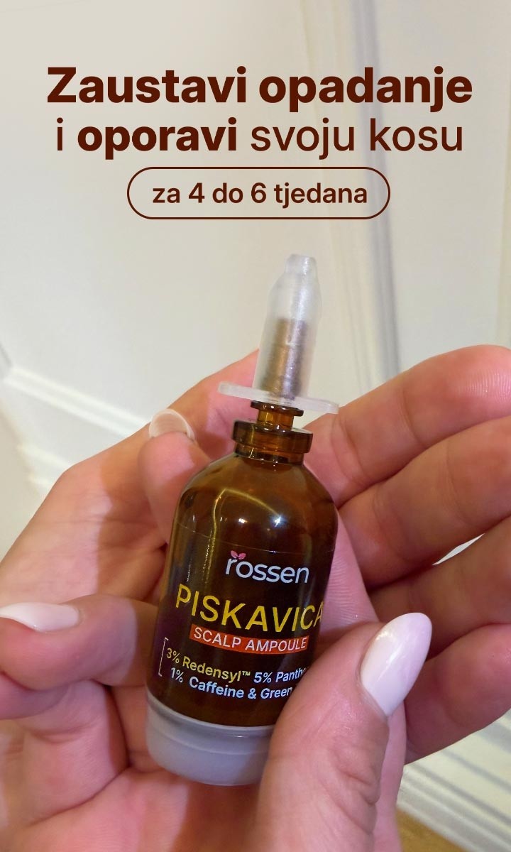 PISKAVICA-BANER-U-RUCI---MOB---HR